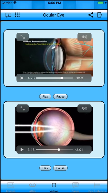 Ocular Eye screenshot-3