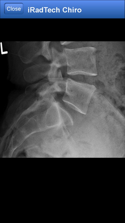 iRadTech Chiro screenshot-4