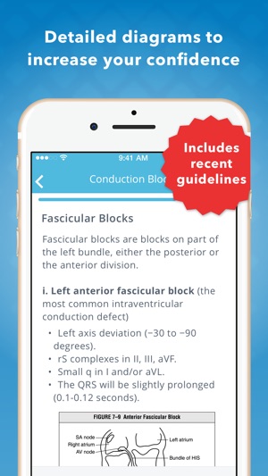 ECG EKG Mastery(圖1)-速報App