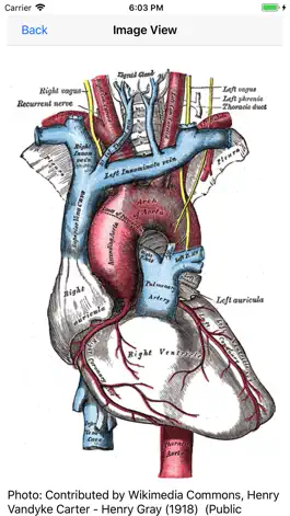 Game screenshot Vascular Board Review hack