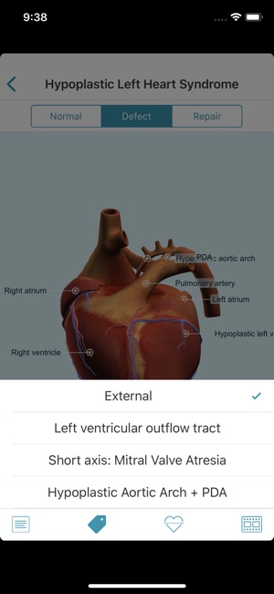 Heartpedia(圖8)-速報App