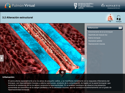 M3: Pulmón Virtual – Asma Bronquial screenshot 4