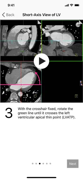 Game screenshot Cardiac Imaging Planes 1-2-3 mod apk