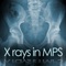 The mucopolysaccharidoses (MPS) represent a group of inheritable, clinically heterogeneous lysosomal storage disorders, in which progressive accumulation of glycosaminoglycans (GAGs) can affect organs and tissues all over the body