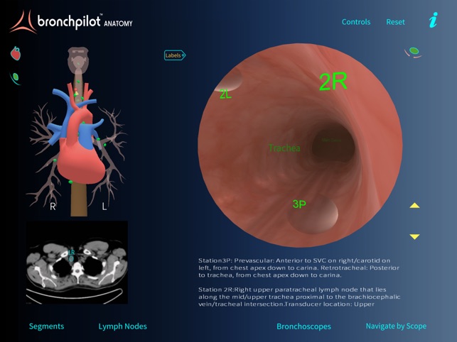 BronchPilot ANATOMY(圖3)-速報App