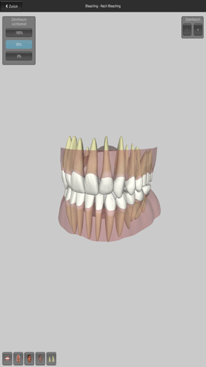 CGM VISODENT 3D App(圖2)-速報App