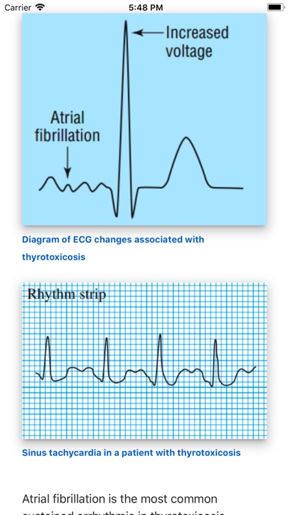 ECG Basics Lite: ECG Made Easy