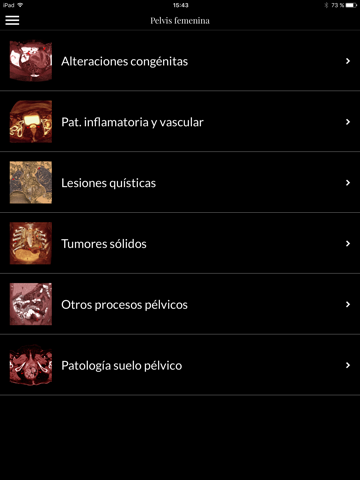 Patología 3D Ginecología screenshot 2