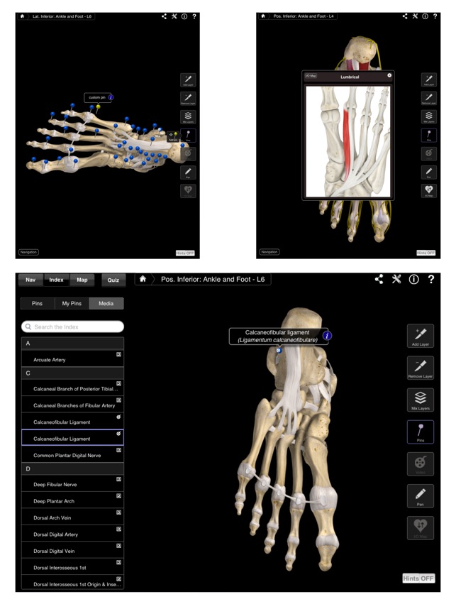 Ankle & Foot Pro III for iPad(圖4)-速報App