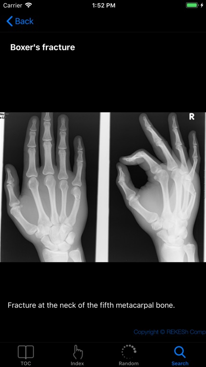 Atlas of Radiological Images screenshot-4