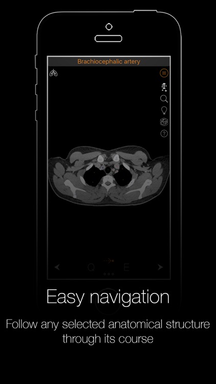 CT Anatomy screenshot-4