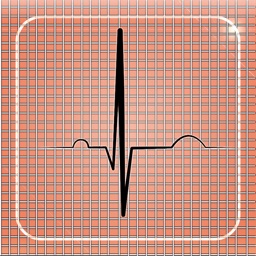 Cardiac-Stress-Test