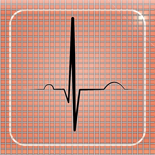 Cardiac-Stress-Test