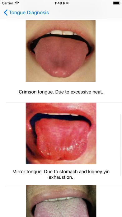Tongue Diagnosis screenshot 3