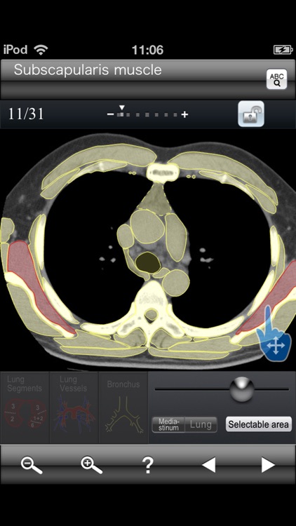 Chest CT Sectional Walker screenshot-4