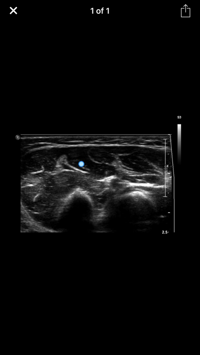 Muscle Ultrasound Course screenshot 4
