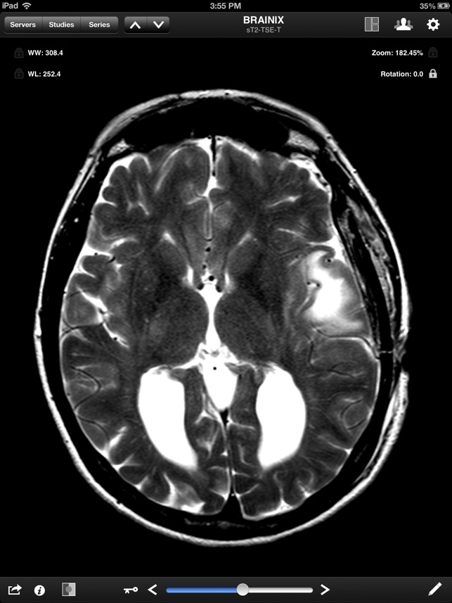 Jack Imaging Medical(圖3)-速報App