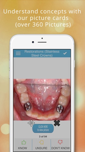 NBDE Dental Board - Pediatrics(圖2)-速報App