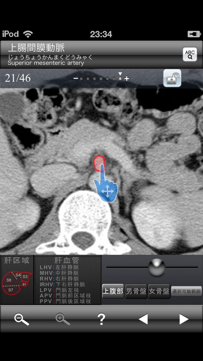 断面図ウォーカー腹部CT
