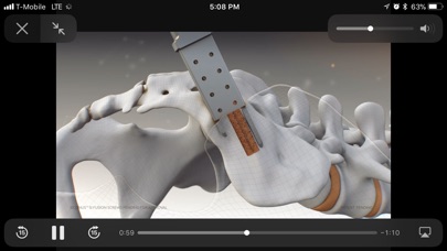Camber Spine Technologies screenshot 4