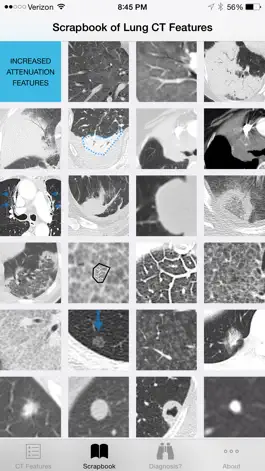 Game screenshot Lung CT Field Guide hack