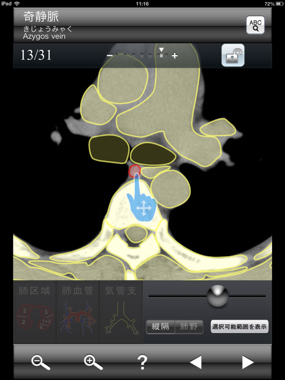 断面図ウォーカー胸部CTのおすすめ画像5