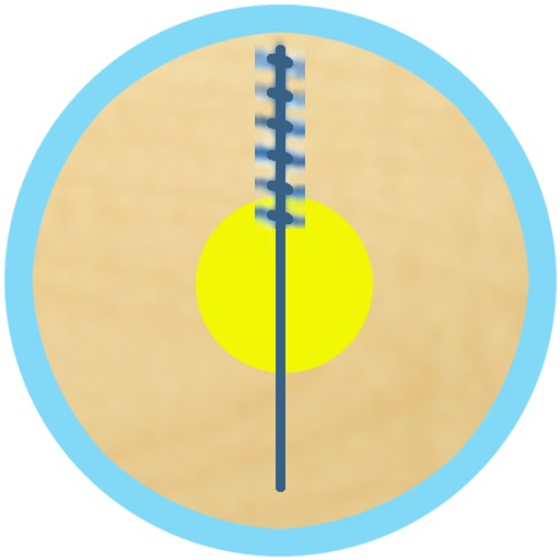 Dry Needling