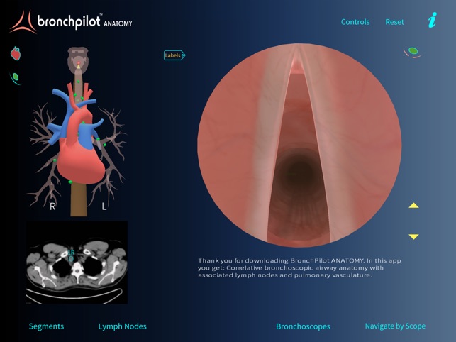 BronchPilot ANATOMY(圖2)-速報App