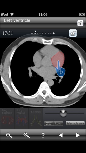 Chest CT Sectional Walker