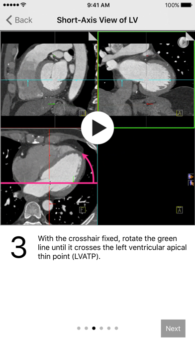 How to cancel & delete Cardiac Imaging Planes 1-2-3 from iphone & ipad 1