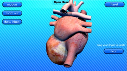 Open Heart Motion screenshot 3