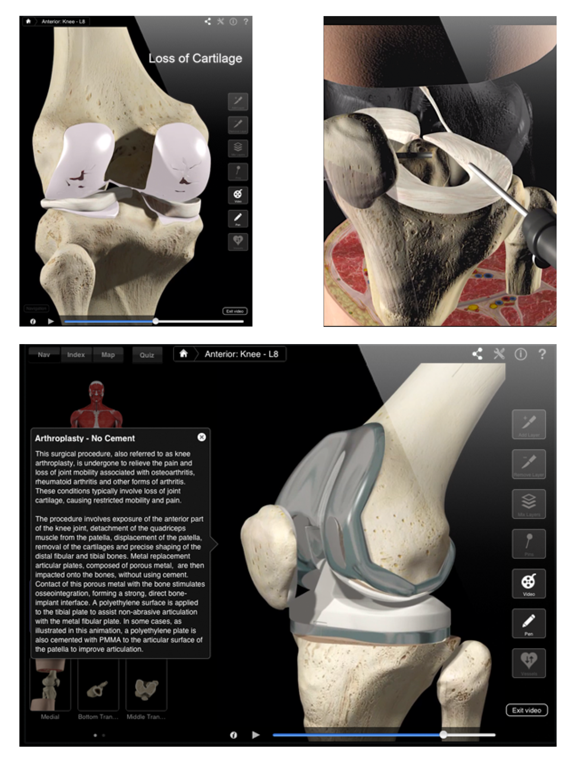 Knee Pro III for iPadのおすすめ画像2