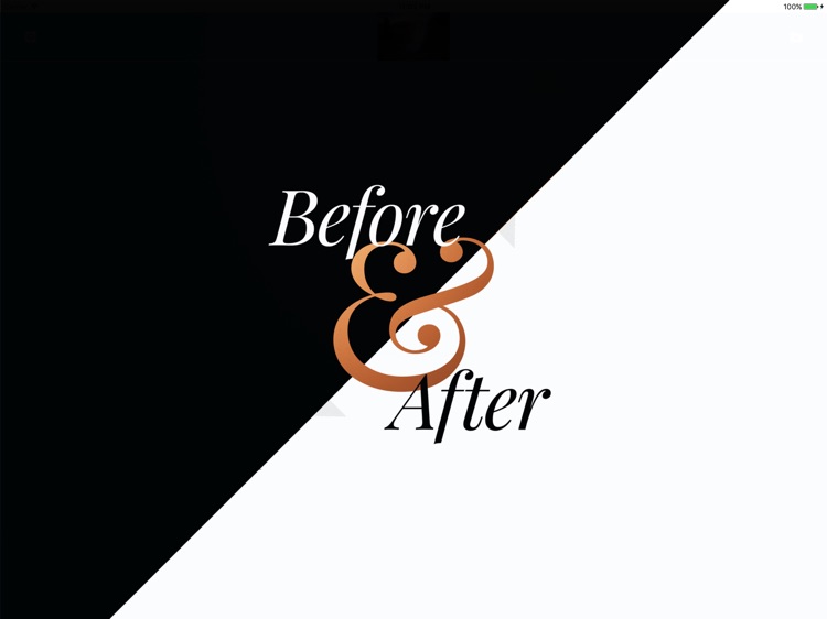 Before and After Gallery