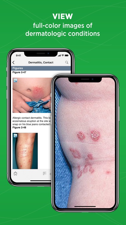 5 Minute Clinical Consult screenshot-4