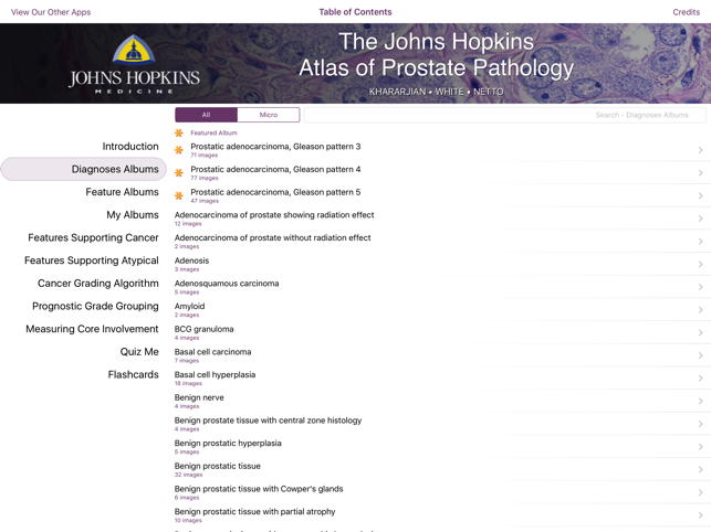 Hopkins Prostate Pathology