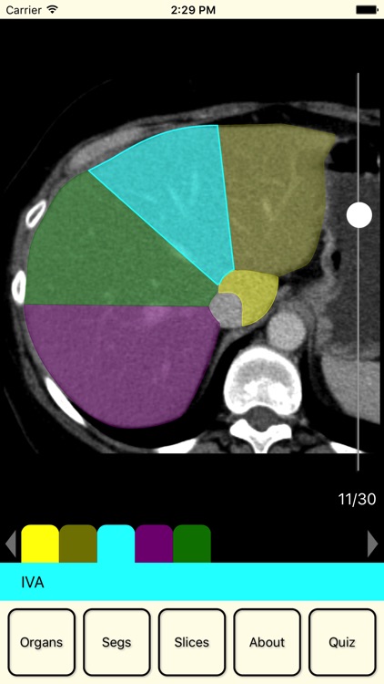 RadAnatomy
