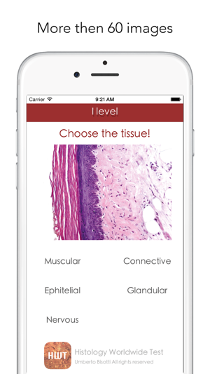 Histology Worldwide Test for iPhone(圖2)-速報App