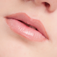 Lip Injection 101 Reference of Cosmetic Surgery and Video Guide