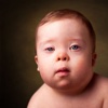 Down Syndrome Guide:New Parents' Guide