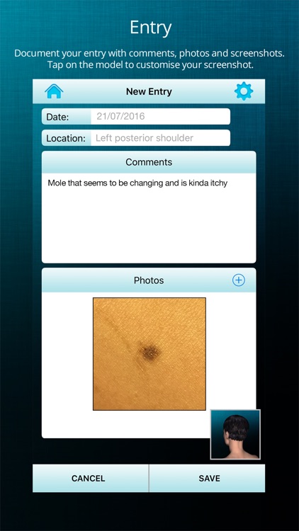 ApreSkin you - track your moles, skin cancers / melanoma and blemishes screenshot-1