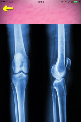X-Ray Body Bones Scanner screenshot 4