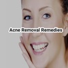 Acne removal remedies