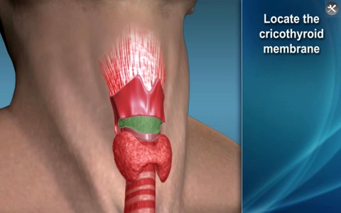 Medrills - Cricothyroidotomy screenshot 2