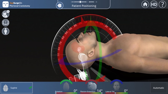 Pterional Craniotomy(圖3)-速報App