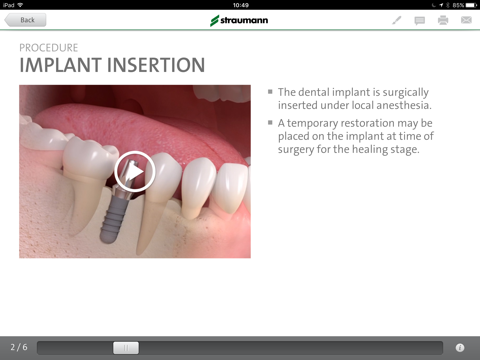 Straumann® Patient Education Appのおすすめ画像2