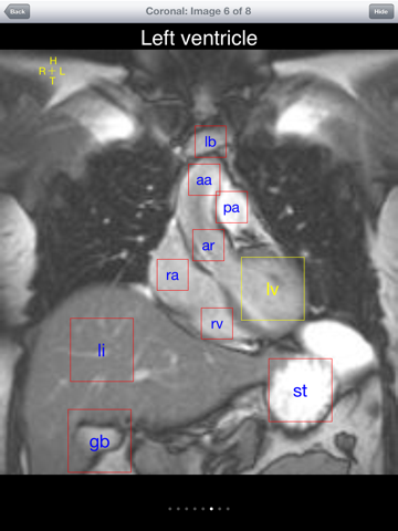 iAnatomy-Cardiac - náhled
