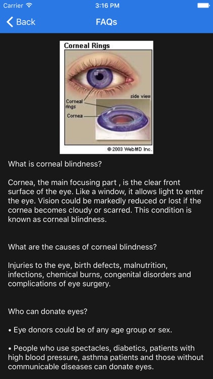 Netradaan - Donate Your Eyes !