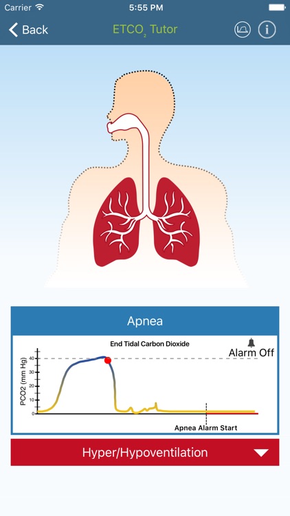 ETCO2 Tutor