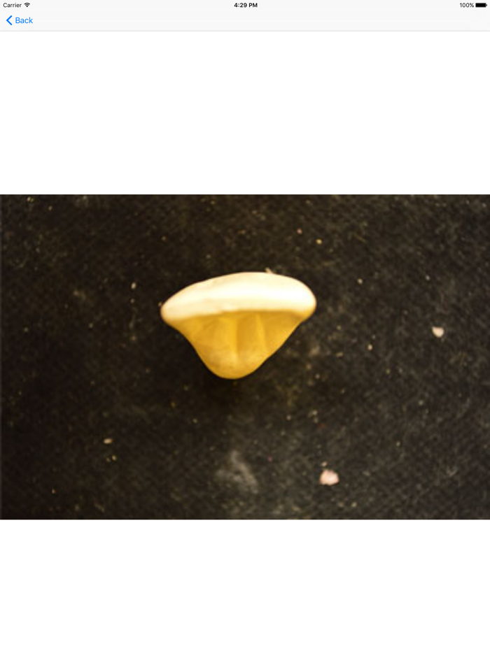 Tooth Morphology - Your Quick Reference Guide