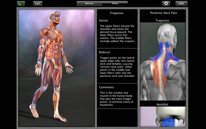 Muscle Trigger Point ... screenshot1